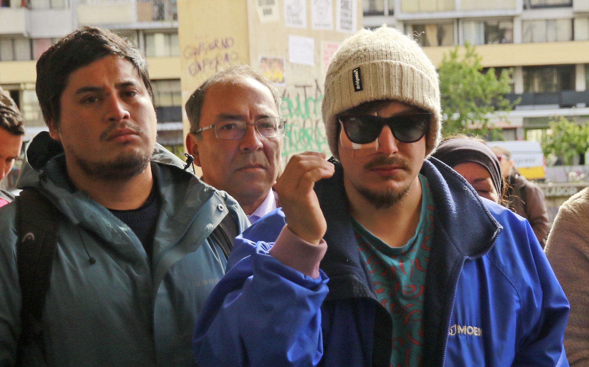 Declaran alerta sanitaria por pérdidas oculares en la provincia de Concepción - Diario Concepción
