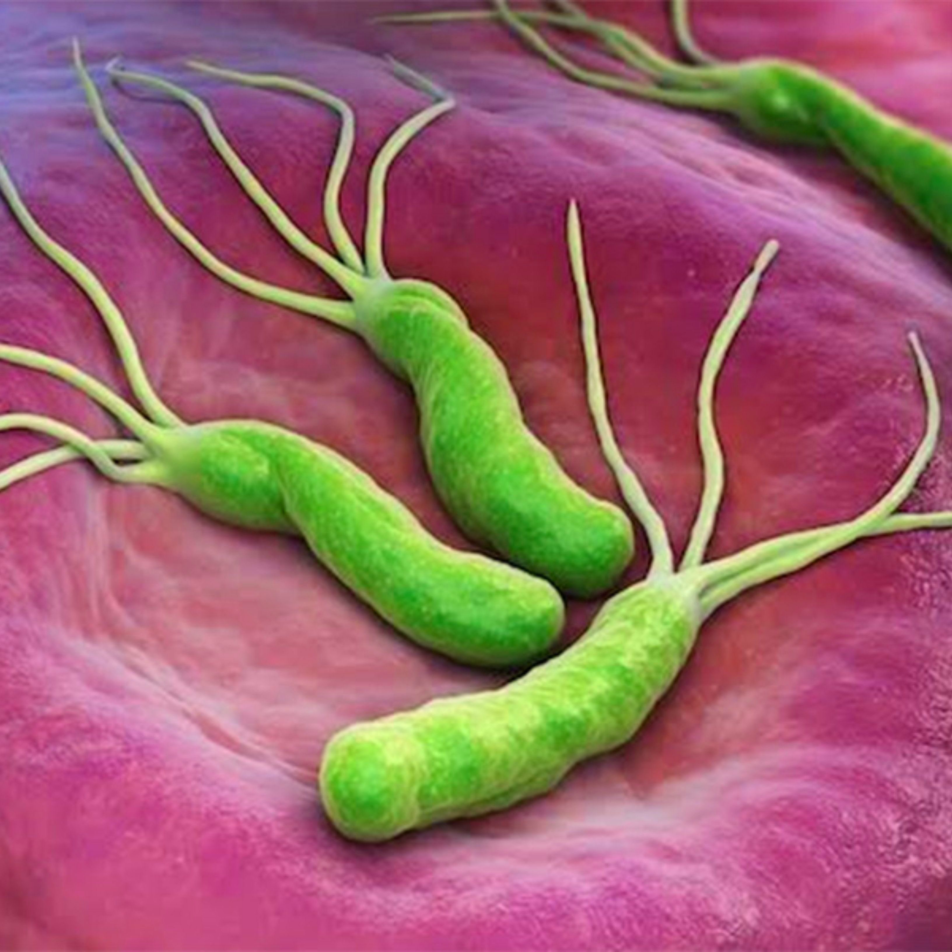 Причины появления бактерий в желудке. Хеликобактер хеликобактер пилори. Бактерии хеликобактер пилори (Helicobacter pylori). Хеликобактер пилори в микроскопе. Бактерия гастрита хеликобактер.